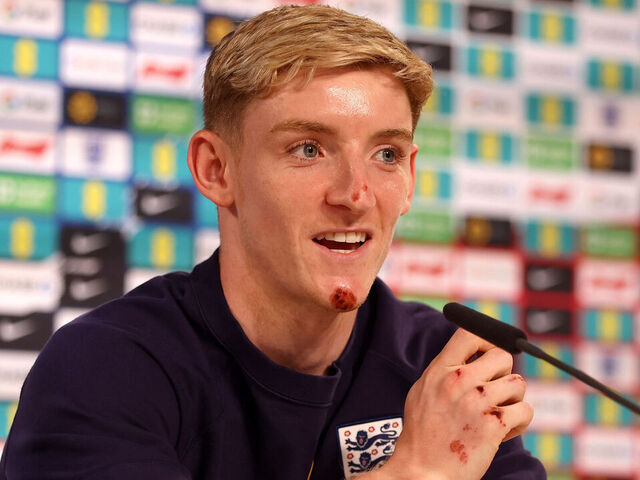 Battered and Bruised, Gordon Aims to Ignite England's Euro 2024 Campaign - Seasports